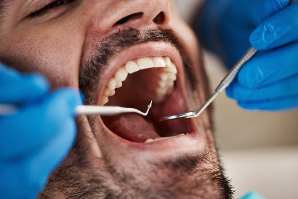 Best Emergency Broken Tooth Repair in Viola, IL